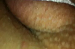 Ausgezogen und klett ...